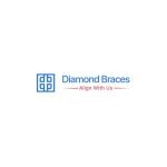 Diamond Braces coupons and promo codes